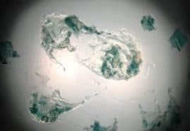 PROTOZOA, reż. 